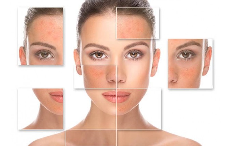 Элоком: Секреты эффективного применения