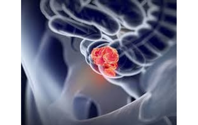 Эрлотиниб: возможности и перспективы лечения