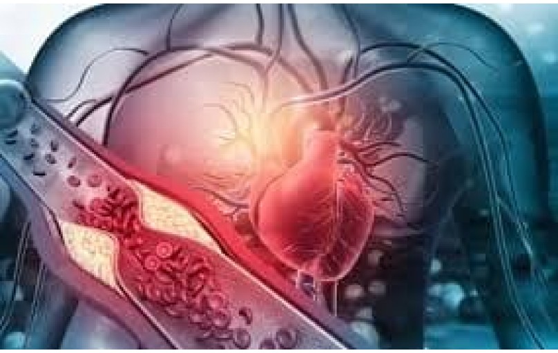 Забота о сердце: Эзетимиб-Симвастатин – что нужно знать?